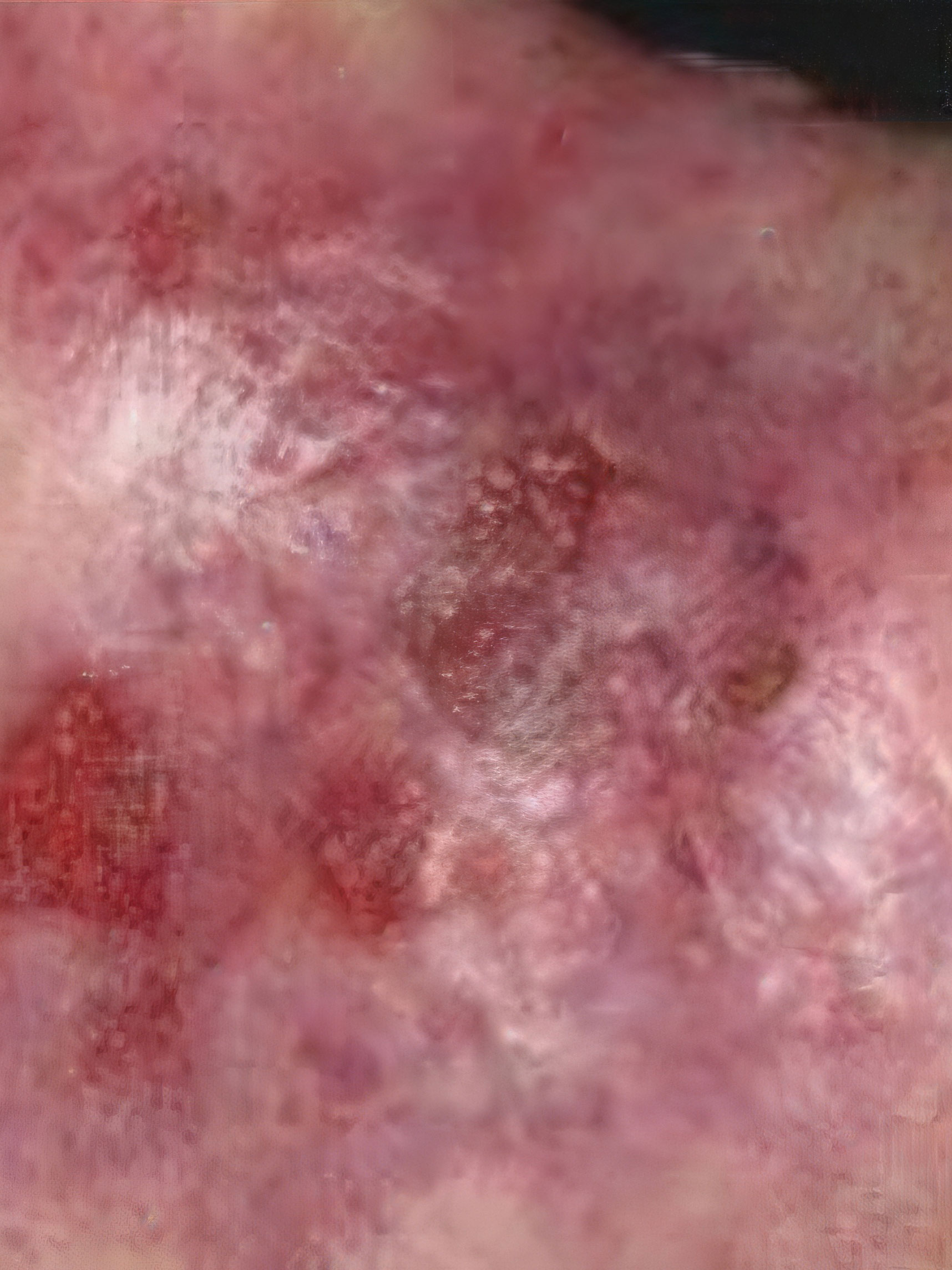 Before treatment example