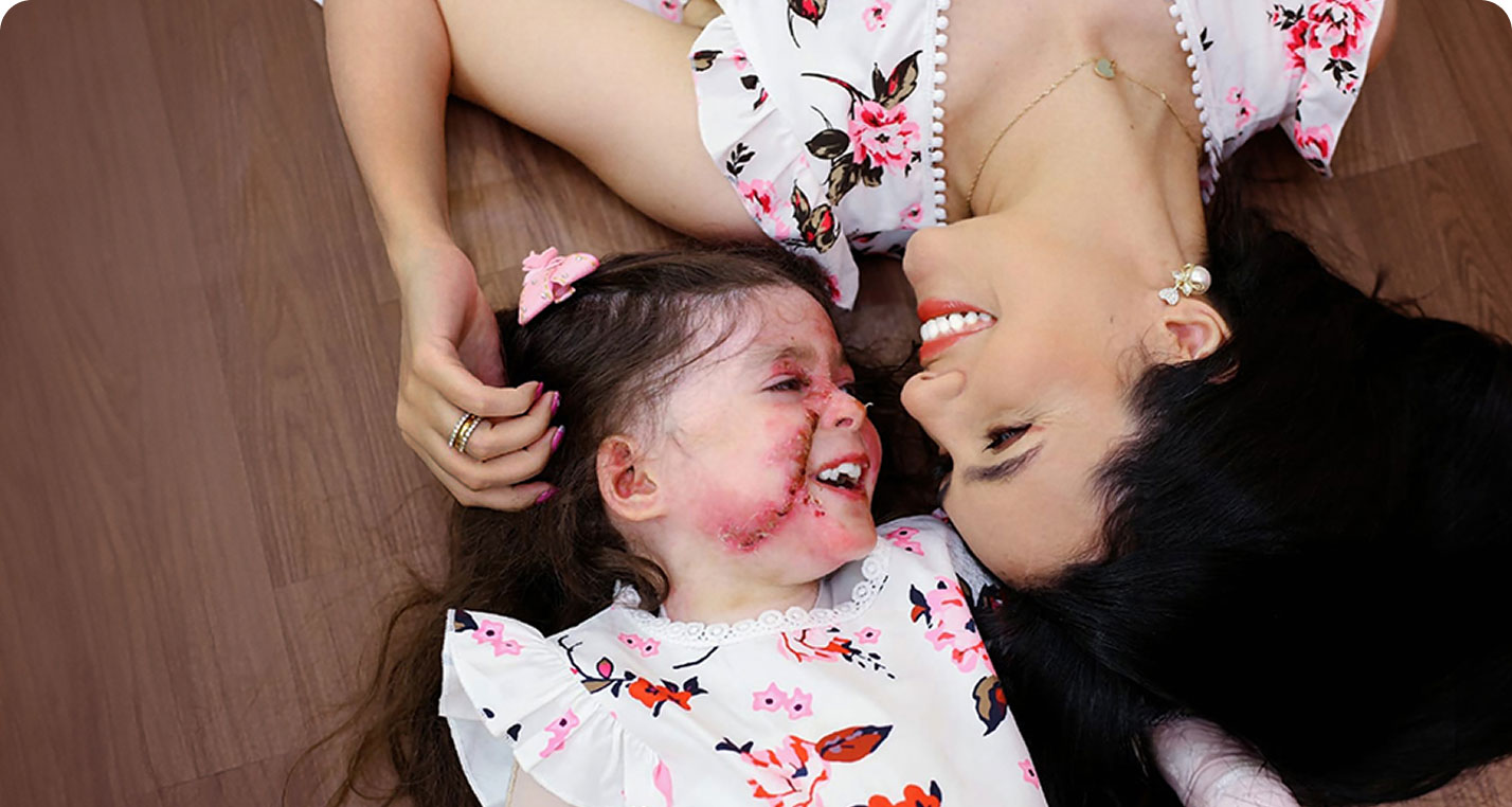 Geovanna, a ZEVASKYN patient, smiling