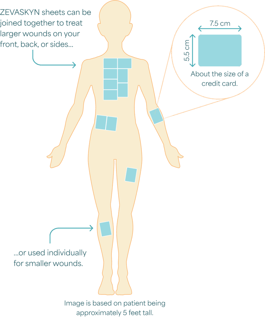 Diagram of ZEVASKYN placement on patient