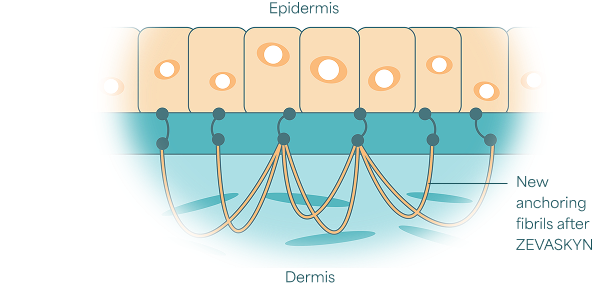 How ZEVASKYN works on skin diagram