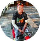 Guadalupe, a patient treated with ZEVASKYN, smiling